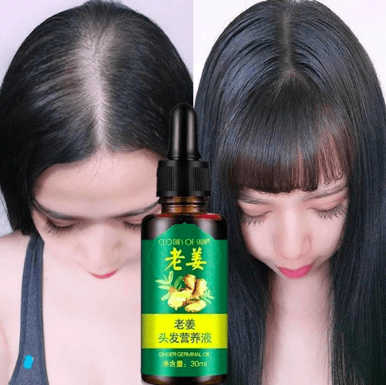 Best 7 Day Hair Growth Serum