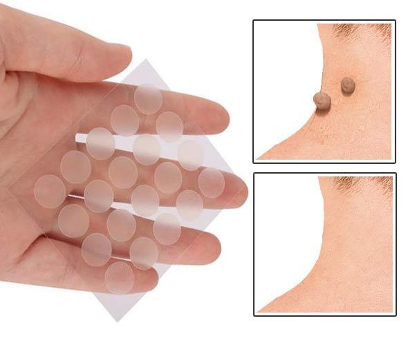 Skin Tag Spot Treatment Patch