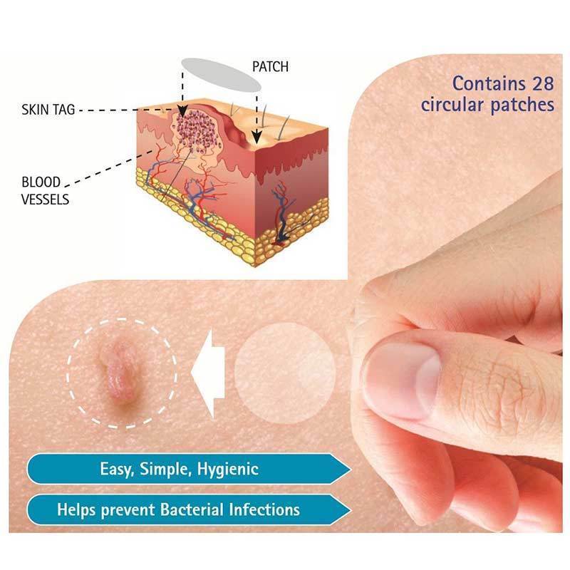 Skin Tag Spot Treatment Patch